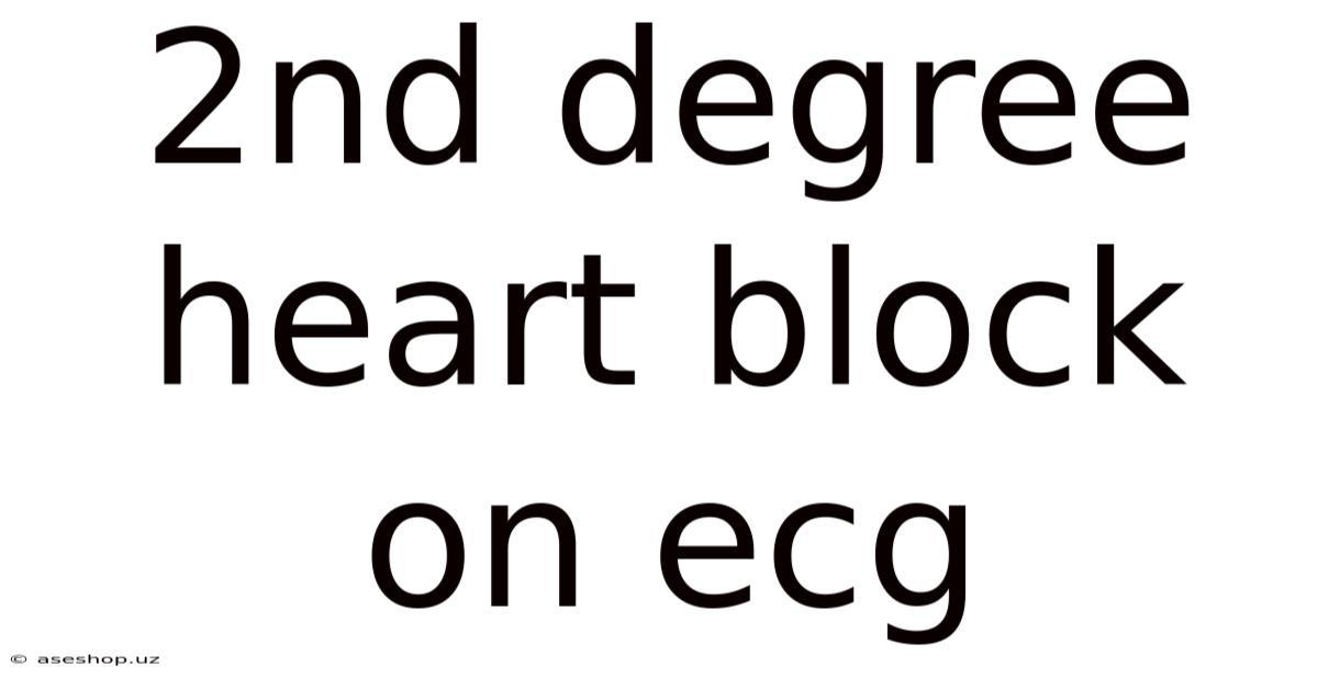 2nd Degree Heart Block On Ecg