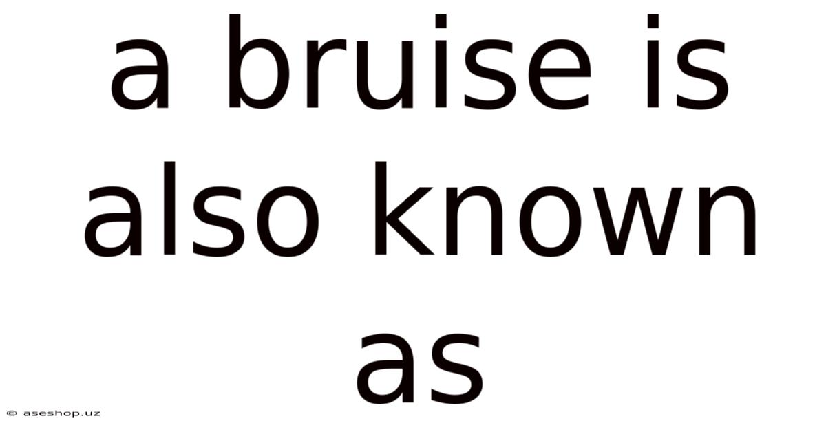 A Bruise Is Also Known As