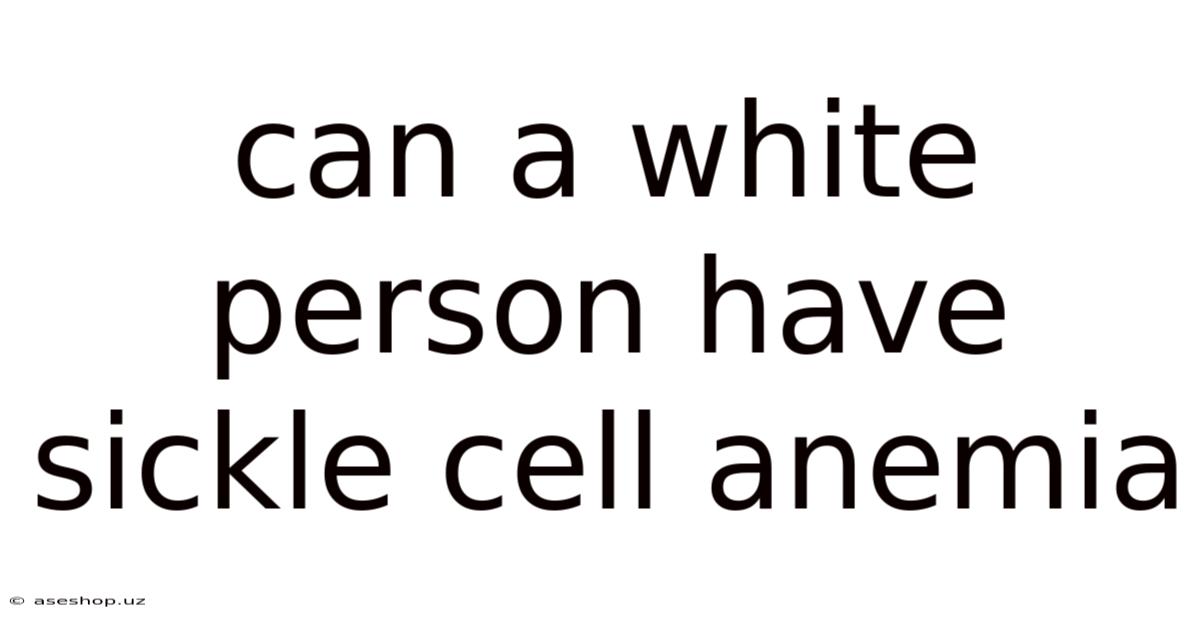 Can A White Person Have Sickle Cell Anemia