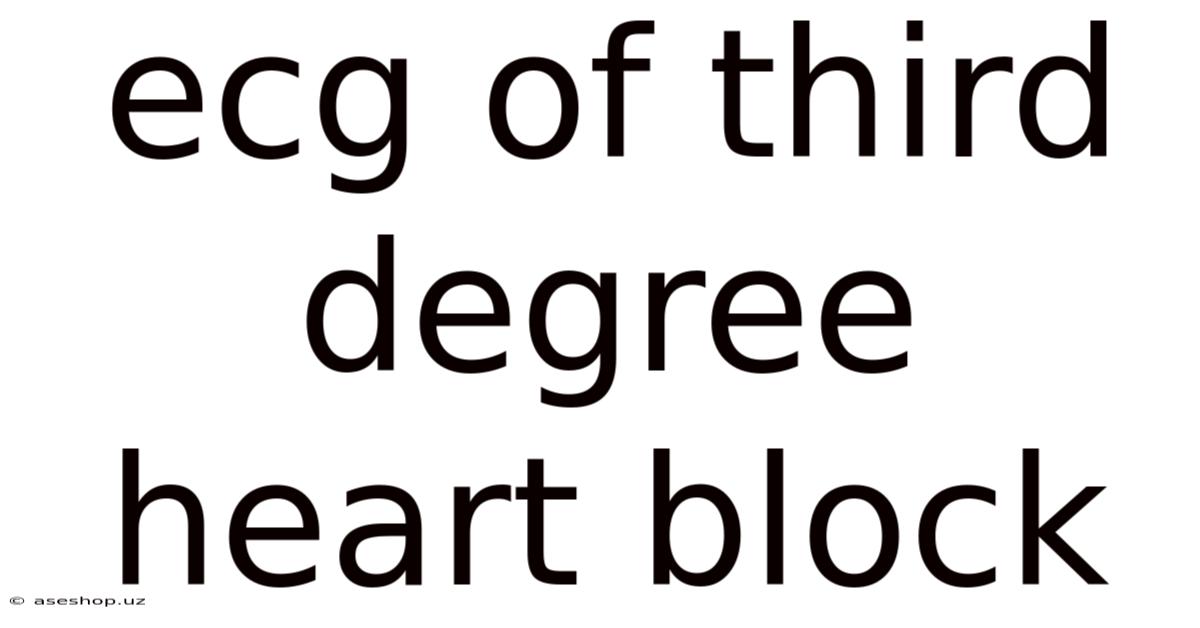 Ecg Of Third Degree Heart Block