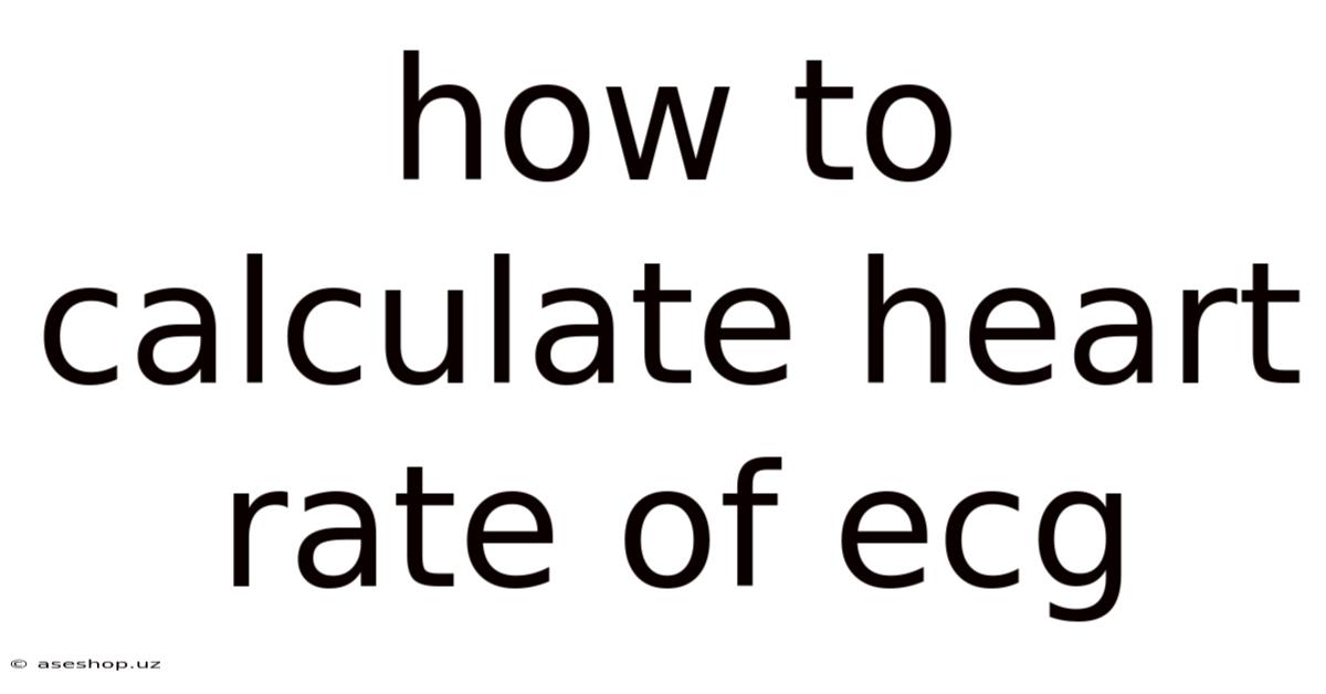 How To Calculate Heart Rate Of Ecg