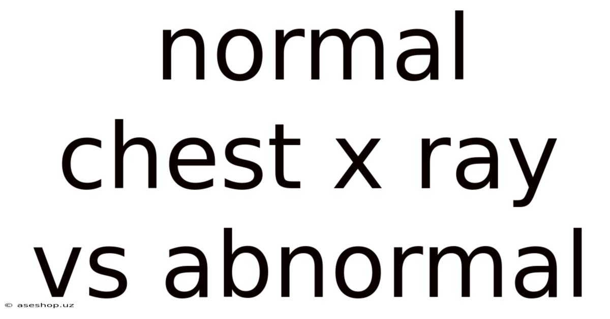 Normal Chest X Ray Vs Abnormal