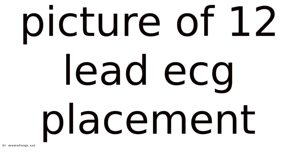 Picture Of 12 Lead Ecg Placement