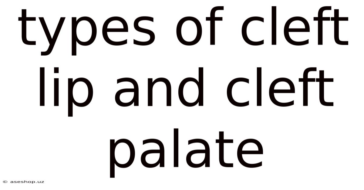 Types Of Cleft Lip And Cleft Palate
