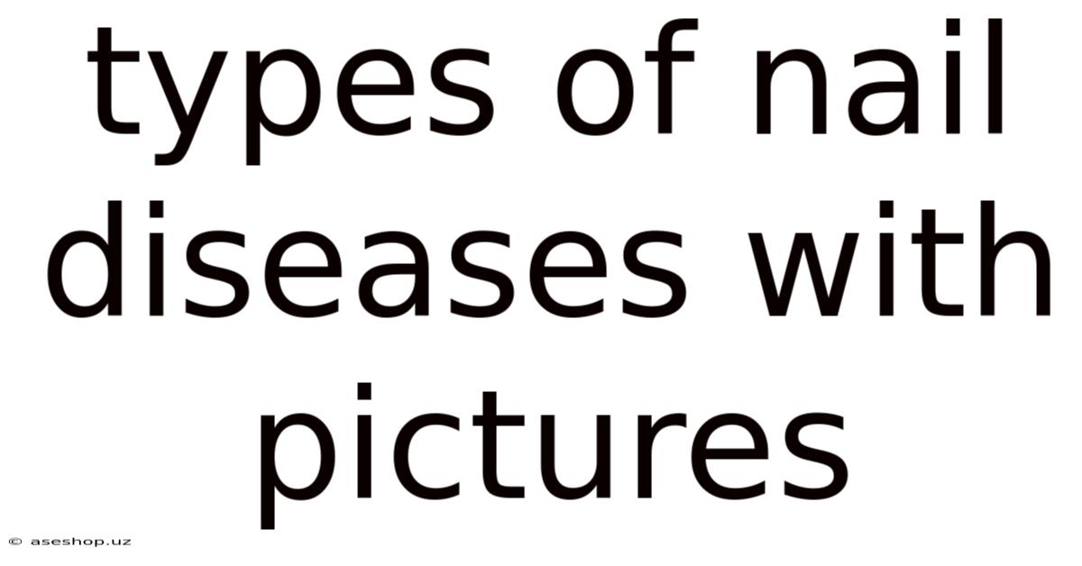 Types Of Nail Diseases With Pictures