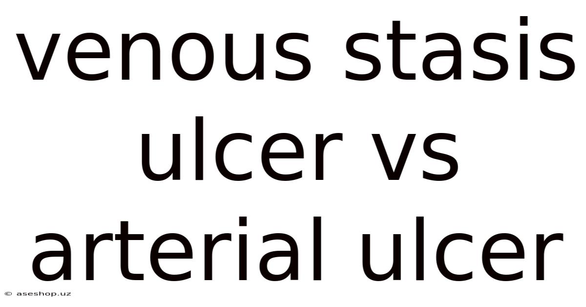 Venous Stasis Ulcer Vs Arterial Ulcer